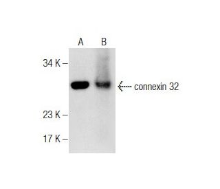 connexin 32 Antibody (CXN-32) - Western Blotting - Image 282489The Double Nickase Plasmid features a U6 promoter for sgRNA expression, a 20 nt targeting sequence, and a gRNA scaffold to guide Cas9n. It includes a CBh promoter for Cas9n (D10A) and puromycin resistance, GFP for transfection verification, and nuclear localization signals (NLS). The 2A peptide allows co-expression of Cas9n and Puro from a single promoter, enabling precise genome editing with reduced off-target effects.