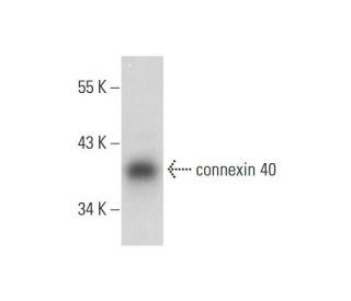 connexin 40 Antibody (B-3) - Western Blotting - Image 298643The Double Nickase Plasmid features a U6 promoter for sgRNA expression, a 20 nt targeting sequence, and a gRNA scaffold to guide Cas9n. It includes a CBh promoter for Cas9n (D10A) and puromycin resistance, GFP for transfection verification, and nuclear localization signals (NLS). The 2A peptide allows co-expression of Cas9n and Puro from a single promoter, enabling precise genome editing with reduced off-target effects.