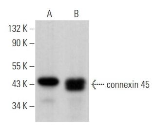 connexin 45 Antibody (G-7) - Western Blotting - Image 363742Each CRISPR/Cas9 Knockout (KO) Plasmid product consists of a pool of 3 plasmids designed to ensure identification and cleavage of a specific gene for maximum knockout efficiency. Each plasmid encodes a unique 20 nt sequence derived from the GeCKO (v2) library.