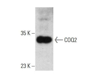 COQ2 Antibody (2B4) - Western Blotting - Image 384457 