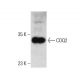 COQ2 Antibody (2B4) - Western Blotting - Image 384457 