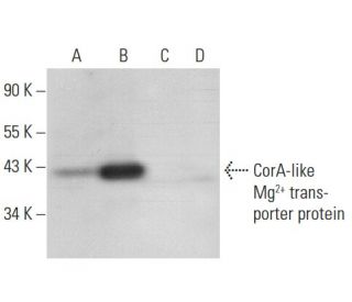CorA-like Mg<sup>2+</sup> transporter protein Antibody (A-9) - Western Blotting - Image 303759 