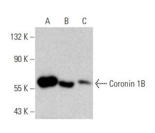 Coronin 1B Antibody (G-8) - Western Blotting - Image 358725 