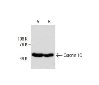 Coronin 1C Antibody (D-9) - Western Blotting - Image 160546 