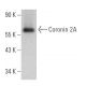 Coronin 2A Antibody (A-3) - Western Blotting - Image 366822