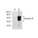 Coronin 2A Antibody (C-7) - Western Blotting - Image 154784