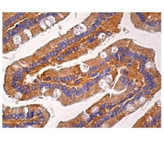 Coronin 2A Antibody (H-2) - Immunohistochemistry - Image 157969 