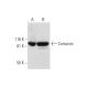 Cortactin Antibody (H-1) - Western Blotting - Image 298608 