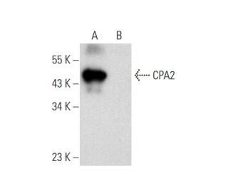 CPA2 Antibody (B-8) - Western Blotting - Image 297842