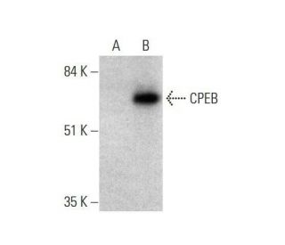 CPEB Antibody (A-9) - Western Blotting - Image 351674 