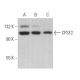 CPSF2 Antibody (A-9) - Western Blotting - Image 375053 