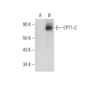 CPT1-C Antibody (B-1) - Western Blotting - Image 323829SAM Transcription Activation: SAM system utilizing dCas9-VP64, MS2-P65-HSF1, and sgRNA for precise gene transcription activation.