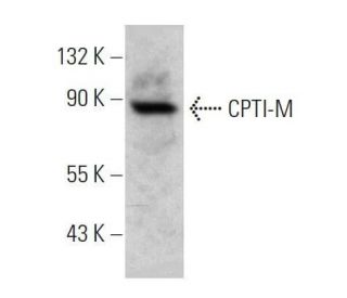 CPTI-M Antibody (D-8) - Western Blotting - Image 358676