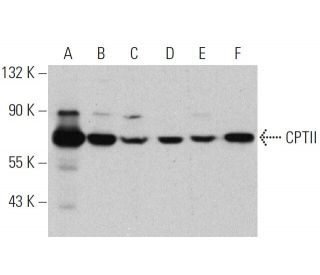 CPTII Antibody (G-5) - Western Blotting - Image 359954 