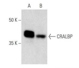 CRALBP Antibody (B2) - Western Blotting - Image 357261 