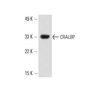 CRALBP Antibody (D-10) - Western Blotting - Image 12555 