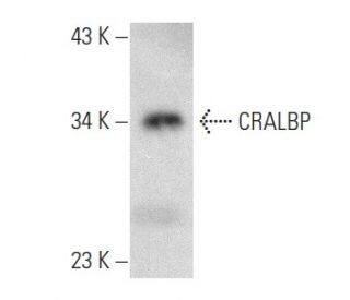 CRALBP Antibody (G-9) - Western Blotting - Image 357262 