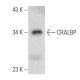CRALBP Antibody (G-9) - Western Blotting - Image 357262 