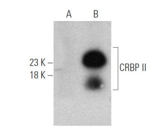 CRBP II Antibody (8-1#) - Western Blotting - Image 374583