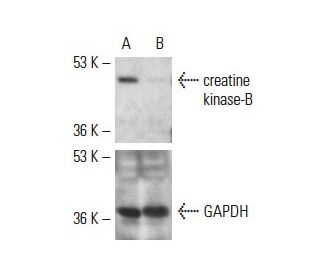 creatine kinase-B siRNA (h): sc-35107. Western blot analysis of creatine kinase-B expression in non-transfected control (A 