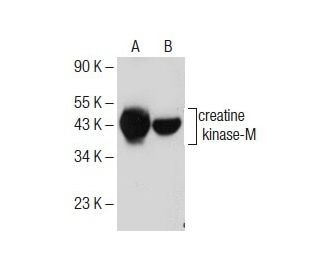 creatine kinase-M Antibody (H-9) - Western Blotting - Image 285397 