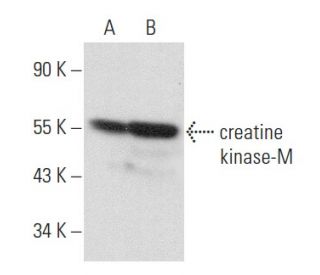 creatine kinase-M Antibody (MM-2) - Western Blotting - Image 358005 