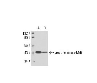 creatine kinase-M/B Antibody (1.BB.105) - Western Blotting - Image 17571 