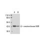 creatine kinase-M/B Antibody (1.BB.105) - Western Blotting - Image 17571 