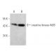 creatine kinase-M/B Antibody (1.BB.105) - Western Blotting - Image 368004
