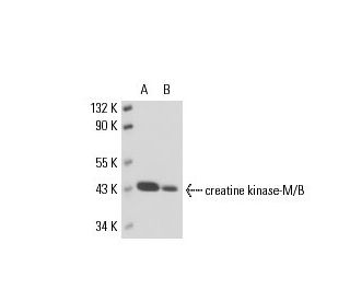 creatine kinase-M/B Antibody (BDI937) - Western Blotting - Image 17570