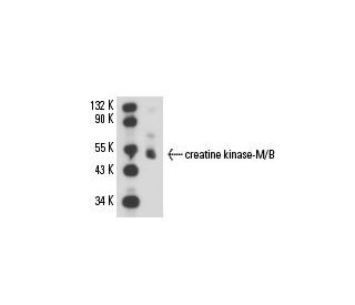 creatine kinase-M/B Antibody (CK-10) - Western Blotting - Image 15812