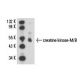 creatine kinase-M/B Antibody (CK-10) - Western Blotting - Image 15812