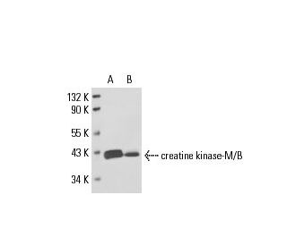 creatine kinase-M/B Antibody (CK1) - Western Blotting - Image 17572