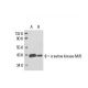 creatine kinase-M/B Antibody (CK1) - Western Blotting - Image 17572