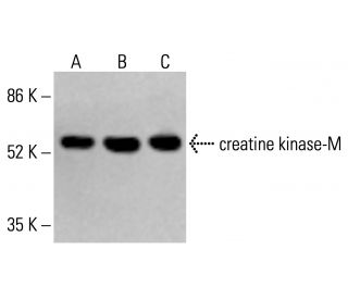 creatine kinase-M Antibody (MM-25) - Western Blotting - Image 413248