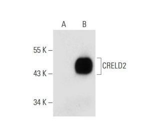 CRELD2 Antibody (A-8) - Western Blotting - Image 300092 