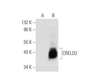 CRELD2 Antibody (C-6) - Western Blotting - Image 300090