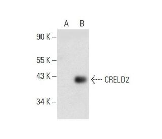 CRELD2 Antibody (C-7) - Western Blotting - Image 137561
