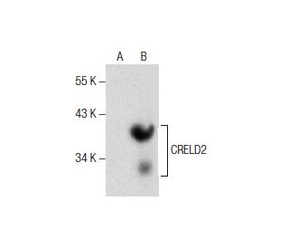 CRELD2 Antibody (D-5) - Western Blotting - Image 157503