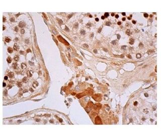 CREM Antibody (22) - Immunohistochemistry - Image 352261 