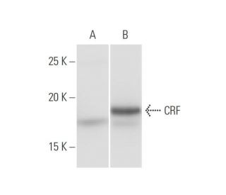 CRF Antibody (2B11) - Western Blotting - Image 347546 