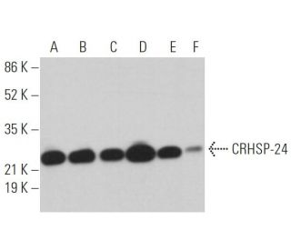 CRHSP-24 Antibody (A-1) - Western Blotting - Image 362995 