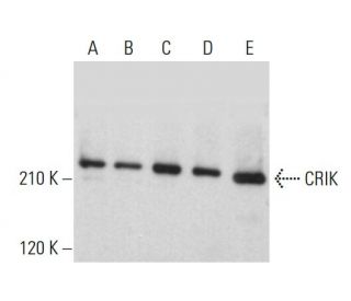 CRIK Antibody (E-6) - Western Blotting - Image 382328 