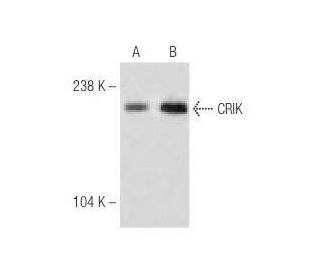 CRIK Antibody (C-5) - Western Blotting - Image 284992