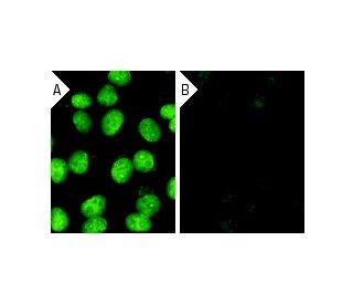 CRM1 siRNA (h): sc-35116. Immunofluorescence staining of methanol-fixed, control HeLa (A) and CRM1 siRNA silenced HeLa (B) 