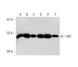 CRP Antibody (26D7) - Western Blotting - Image 145721 