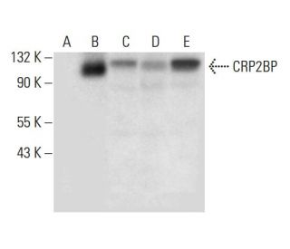 CRP2BP Antibody (A-11) - Western Blotting - Image 305763