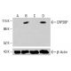 Anticorpo CRP2BP (A-11): sc-398475. Analisi Western blot dell'espressione di CRP2BP in lisati cellulari totali non trattati di K-562 (A), trattati chimicamente di K-562 (B), non trattati di HCT-116 (C) e trattati chimicamente di HCT-116 (D). β-Actina (C4): sc-47778 utilizzata come controllo di caricamento. Reagente di rilevamento utilizzato: m-IgG Fc BP-HRP: sc-525409. CRP2BP Antibody (A-11) - Western Blotting - Image 415467
