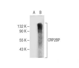CRP2BP Antibody (G-2) - Western Blotting - Image 285427