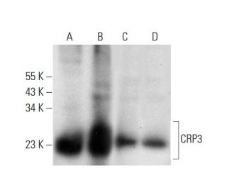 CRP3 Antibody (B-4) - Western Blotting - Image 296968 